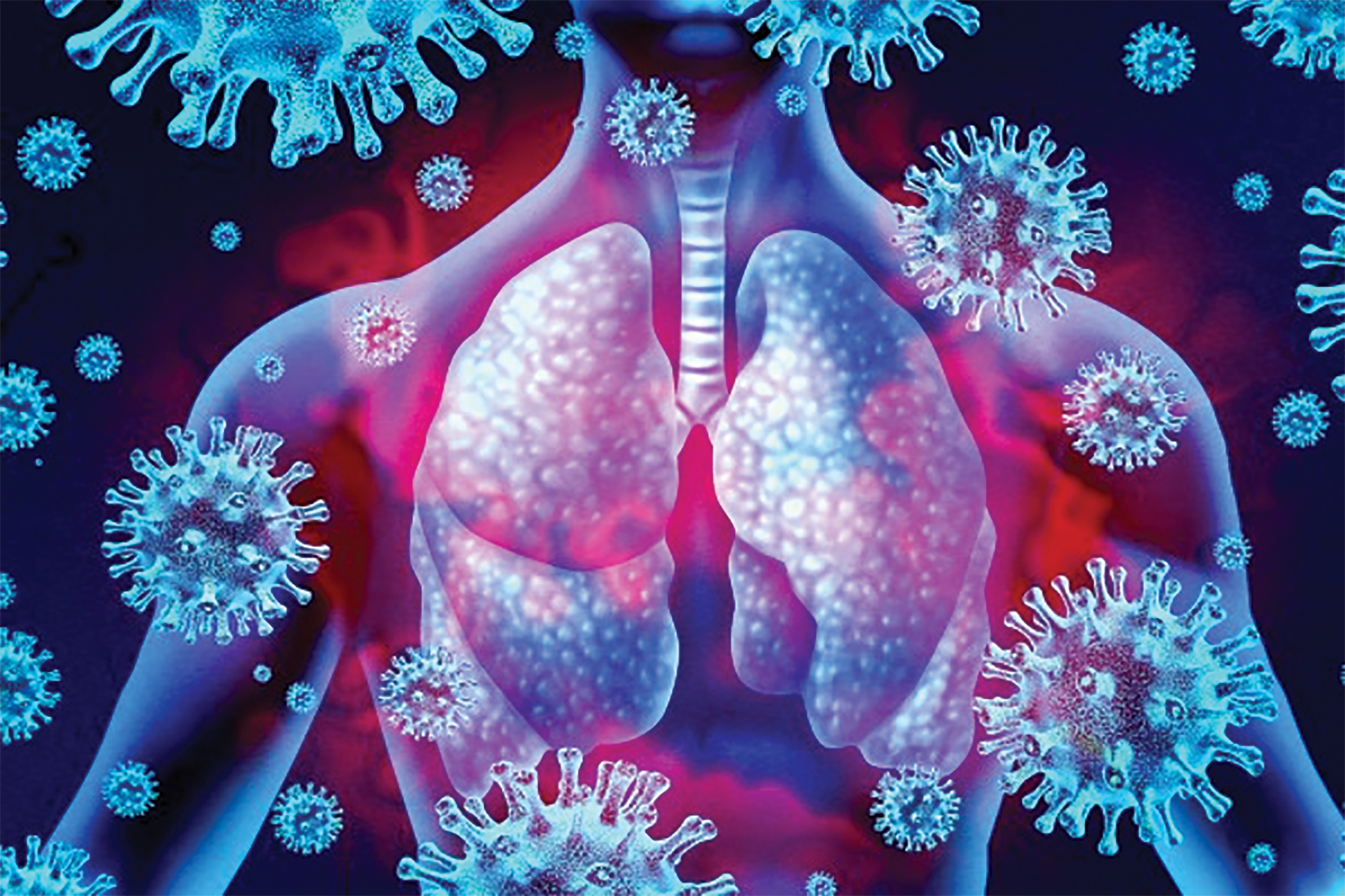 VITAMIN D KEY TO FIGHTING OFF COVID PNEUMONIA