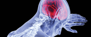 STROKE DEATHS EXPECTED TO RISE TO NEARLY 5 MILLION BY 2030
