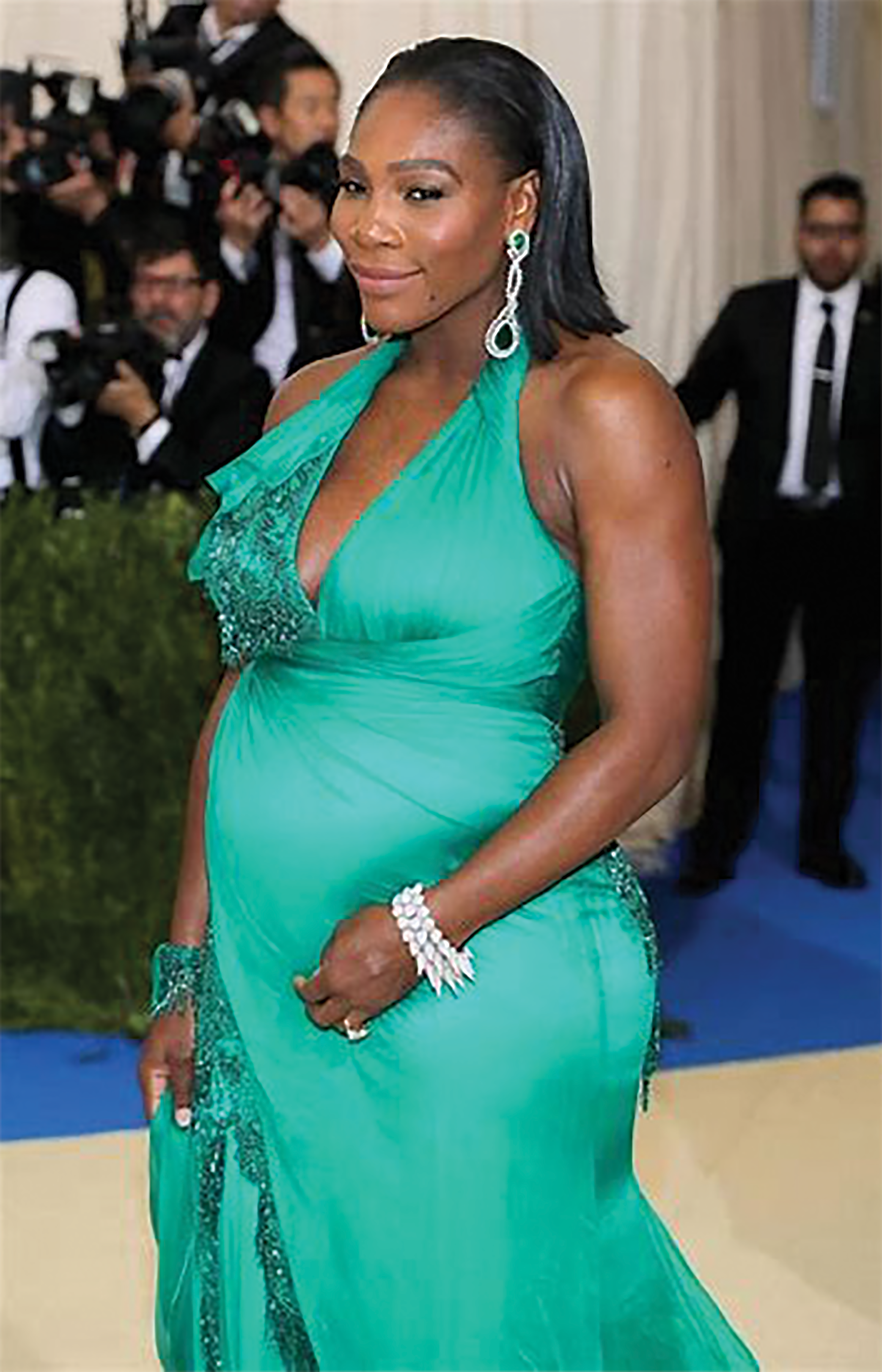 COMPLICATIONS: Tennis great Serena Williams had a history of blood clots and suffered
from a pulmonary embolism, a blockage in the lungs, after giving birth to her
daughter via C-section