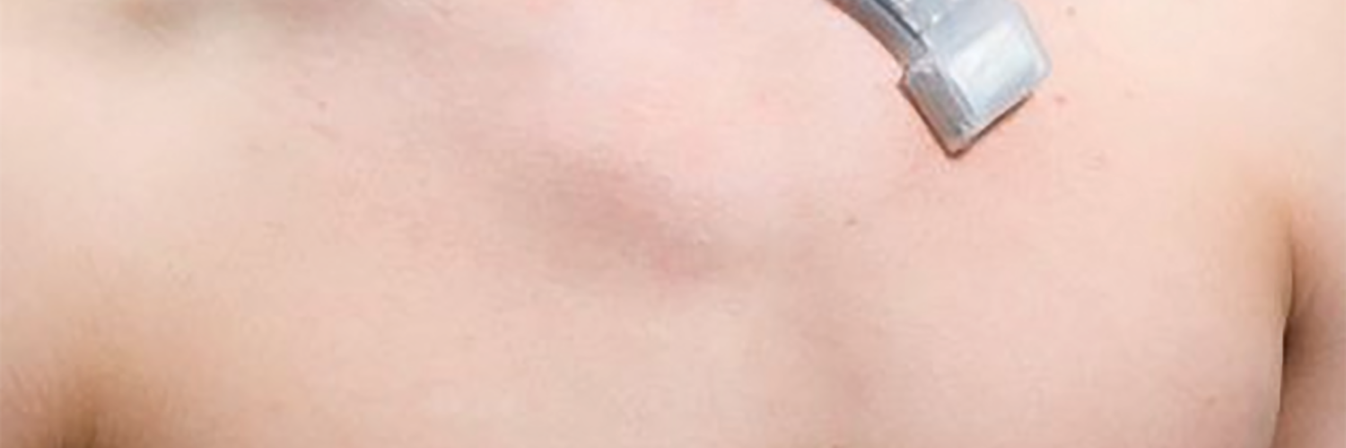 WIRELESS ULTRASOUND PATCH WONDER