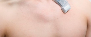WIRELESS ULTRASOUND PATCH WONDER