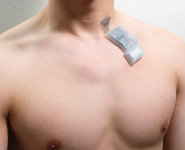 WIRELESS ULTRASOUND PATCH WONDER