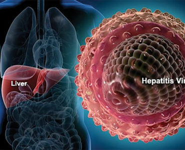 MILLIONS LIVE WITH ‘UNDIAGNOSED HEPATITIS’