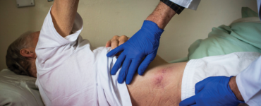 POOR COLON CANCER MEDICAL CARE IN SUB-SAHARAN AFRICA
