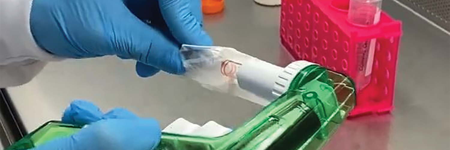 BREAKTHROUGH TREATMENT FOR DIABETESE WOUNDS